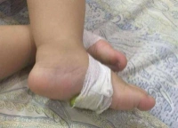 Cách hạ sốt cho trẻ bằng chanh và gừng kèm lưu ý quan trọng